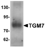 AP55565PU-N - Transglutaminase-7 (TGM7)