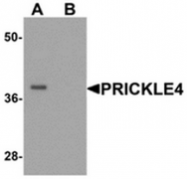 AP55575CP-N - PRICKLE4