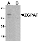 AP55580PU-N - ZGPAT