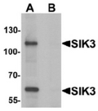 AP55581CP-N - QSK