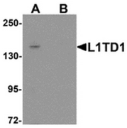 AP55586CP-N - L1TD1