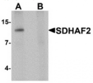 AP55591CP-N - PGL2 / SDHAF2