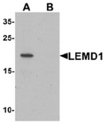 AP55597CP-N - LEMD1