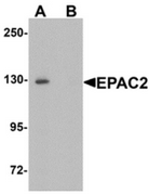 AP55604CP-N - RAPGEF4