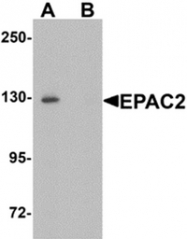 AP55604PU-N - RAPGEF4