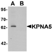 AP55609CP-N - KPNA5 / Importin alpha-6