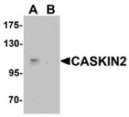 AP55612CP-N - Caskin-2