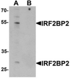 AP55617CP-N - IRF2BP2