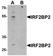 AP55617PU-N - IRF2BP2