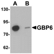 AP55618CP-N - GTP-binding protein 6 / GBP6