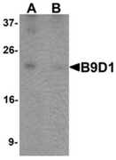 AP55620CP-N - B9D1