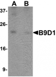 AP55620PU-N - B9D1
