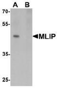 AP55621CP-N - MLIP