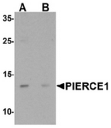 AP55622CP-N - C9orf116
