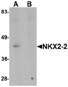 AP55626CP-N - NKX2-2