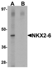 AP55628CP-N - NKX2-6