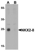 AP55629CP-N - NKX2-8