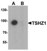 AP55630CP-N - SDCCAG33 / TSHZ1
