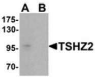 AP55631CP-N - TSHZ2