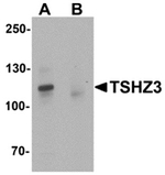 AP55632CP-N - TSHZ3 / ZNF537
