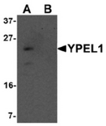 AP55635CP-N - YPEL1