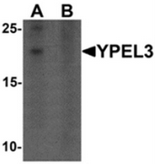AP55637CP-N - YPEL3