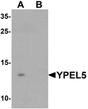 AP55638CP-N - YPEL5