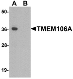 AP55639CP-N - TMEM106A