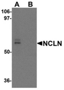 AP55643CP-N - Nicalin