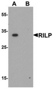 AP55644CP-N - RILP