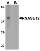 AP55670CP-N - RNASET2