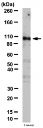 AP55956PU-N - RALBP1
