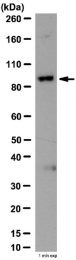 AP55956PU-N - RALBP1