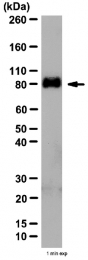 AP55958PU-N - UVRAG