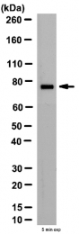 AP55958PU-N - UVRAG