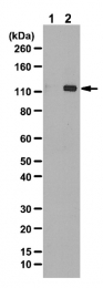 AP55978PU-N - ULK1 / ATG1