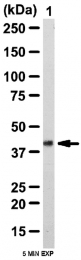 AP55993PU-N - Autophagin-2