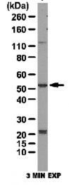 AP55999PU-N - Kallistatin / SERPINA4
