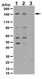 AP56004PU-N - ZFHX1B