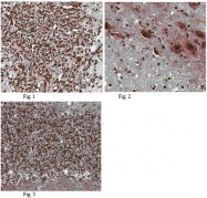 AP56007PU-N - HUNK / MAKV