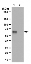 AP56020PU-N - ABI1 / SSH3BP1