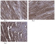 AP56094PU-N - DYNLL2