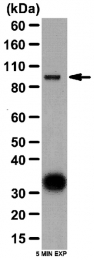 AP56100PU-N - Autotaxin / ENPP2