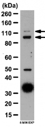 AP56100PU-N - Autotaxin / ENPP2