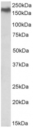 AP60000PU-N - NPC1