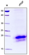 AR31058PU-S - Placenta growth factor / PGF