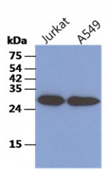 AM50094PU-N - CKAP1 / TBCB
