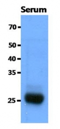 AM50095PU-N - CD16