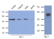 AM50353PU-N - Aminoacylase-1 / ACY1