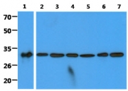 AM50354PU-N - C1QBP
